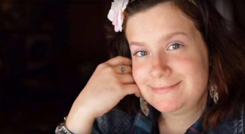 A young woman with a disability grins as she leans her cheek against her fingers